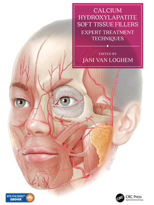 cover image of Calcium Hydroxylapatite Soft Tissue Fillers